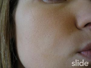 Hospede inúmeras fotos no slide.com GRÁTIS!