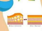 astuce pour perdre poids naturellement