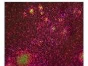 ALZHEIMER: nouvelle voie thérapeutique thérapie génique? PNAS