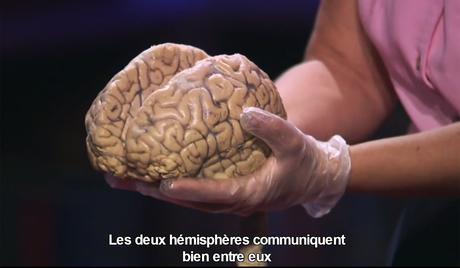 Tedx – Etudier son propre cerveau en plein AVC