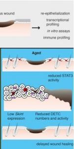 CICATRISATION : Pourquoi elle est ralentie avec l'âge – Cell