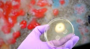 PARKINSON : Et si la maladie commençait dans le microbiote ? – Cell