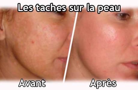 Astuces pour Maigrir ➔ Comment Maigrir vite et Bien !