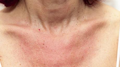 bien preparer sa peau au soleil