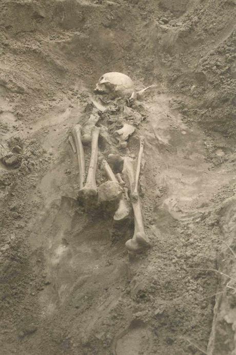 L'ADN du bacille de la peste a été détecté dans les dents de cet individu, qui vivait il y a 2500 ans dans le territoire de l'actuelle Estonie - Harri Moora