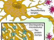 ALZHEIMER Premier vaccin thérapeutique anti-Tau Lancet Neurology