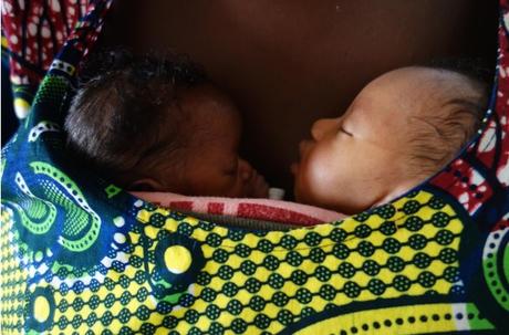PRÉMATURITÉ : Les bébés Kangourou sont toujours plus forts à 20 ans – Pediatrics