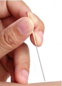 COLIQUE : Quelle efficacité de l'acupuncture ? – Acupuncture in Medicine
