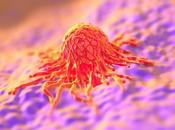 CANCER l'ESTOMAC l'SOPHAGE test d'haleine pour détecter ECCO-the European CanCer Organisation