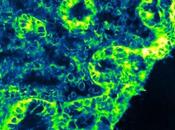 Syndrome CÔLON IRRITABLE L'enzyme inhiber pour symptômes Inserm