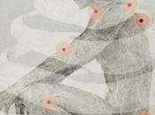 FIBROMYALGIE n'est pot-pourri maladies National Pain Report