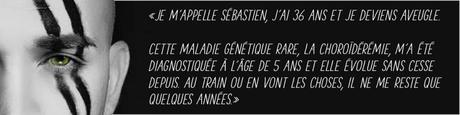 sebastien joachim kick blindness