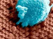 VISION nano-implant wifi pour restaurer Journal Neural Engineering