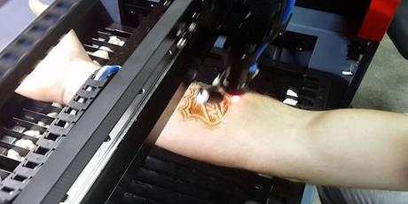 TECHNICART : Tattoos Laser