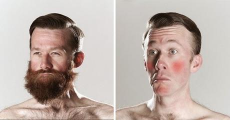 Faites-vous pousser une barbe de hipster pour éviter les irritations