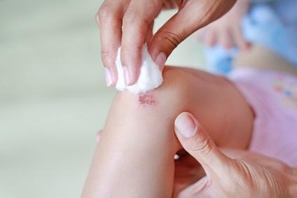 SOIN de PLAIE SUPERFICIELLE : Diriger la cicatrisation à la maison c'est possible ! – American Academy of Dermatology