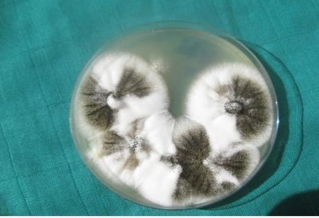 SENSIBILITÉ au GLUTEN : L'enzyme qui change la donne et apporte une sécurité – Digestive Disease Week et Gastroenterology