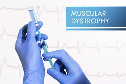 DYSTROPHIE MUSCULAIRE : Des stéroïdes oui mais en prise hebdomadaire  – Journal of Clinical Investigation
