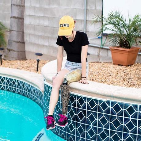 Cette start-up propose des prothèses avec de jolis dessins !