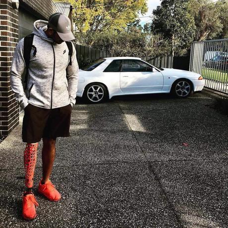 Cette start-up propose des prothèses avec de jolis dessins !