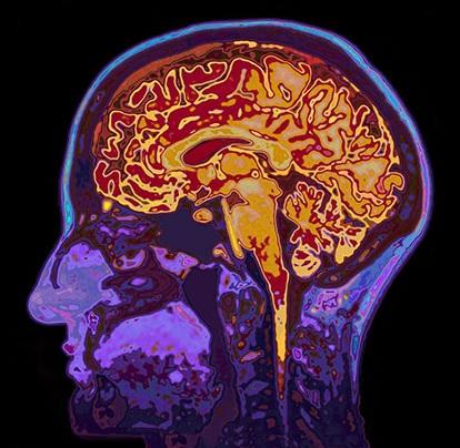 CERVEAU : Il a l'intelligence de compenser avec l'âge – Journal of Neuroscience