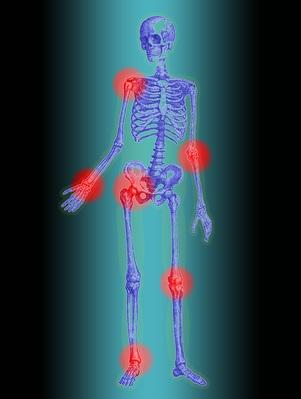 TABAGISME : Actif ou passif, il enfume les articulations  – EULAR 2017