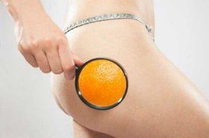 Le patch anti cellulite est-il efficace sur les cuisses, les hanches et les fesses?
