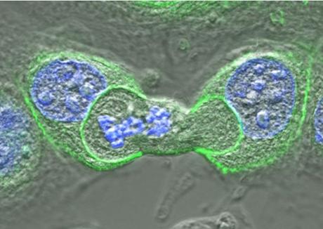 CANCER : Des cellules cannibales pour stopper la croissance tumorale