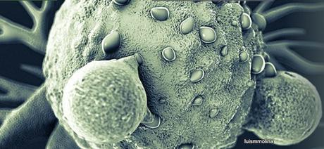 CANCER COLORECTAL : HIPP, le médicament qui coupe les polypes à la racine