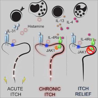 #cell #neuronesensitif #immunité #voiedesignalisation #JAK Les neurones sensitifs cooptent les voies de signalisation classiques de l’immunité relayant les démangeaisons chroniques