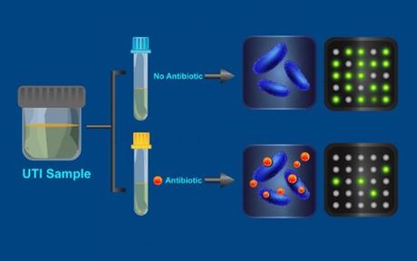 ANTIBIORÉSISTANCE : Le test rapide qui révèle les bactéries rebelles