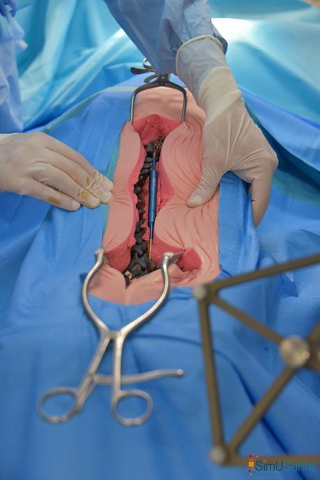 CHU Amiens : une chirurgie robotisée sur la colonne vertébrale d’un enfant