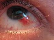 #thelancet #hémorragies #antifibrinolytiques #acidetranexamique Effet d’un délai traitement l’efficacité l’innocuité antifibrinolytiques d’hémorragie sévère méta-analyse données individuelle patients prises chez pati...