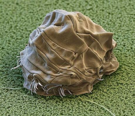 Tardigrade en Cryptobiose