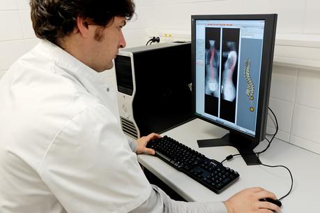 HipEOS agrée par la FDA, un logiciel de planification 3D pour la chirurgie prothétique de hanche