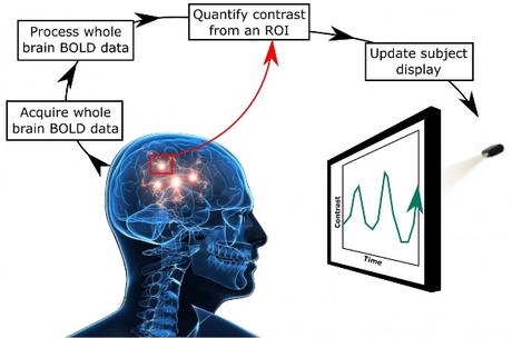 ACOUPHÈNES : Le neurofeedback pour détourner l’attention du cortex auditif