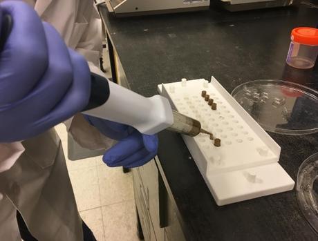 Transplantation du MICROBIOTE FÉCAL : La poop pill contre C. difficile