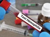 HÉMOPHILIE Premier essai réussi thérapie génique