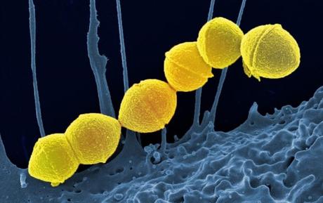 ANTIBIORÉSISTANCE : Réduire la virulence bactérienne, une alternative prometteuse aux antibiotiques