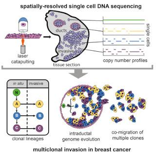#Cell #séquençage #tumeur #cellule Dissémination cellulaire multiclonale dans des tumeurs du sein identifiée par séquençage à l’échelle d’une seule cellule