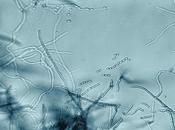 MÉLANOME bactérie révèle effet anticancéreux puissant