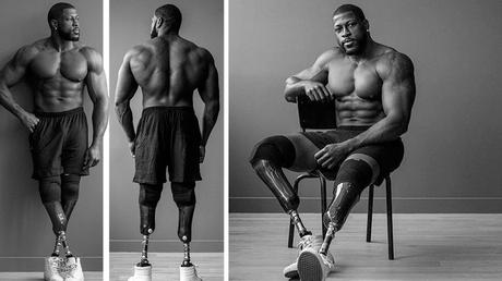 Amputé des deux jambes, Edgard John-Augustin est devenu Bionic Body