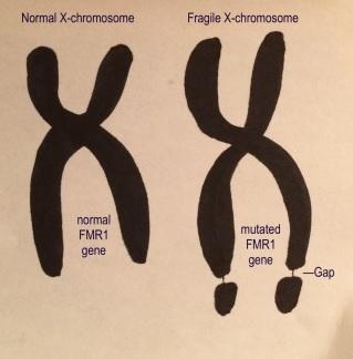 X FRAGILE : Une première explication de l'inflexibilité cognitive X FRAGILE : Une première explication de l'inflexibilité cognitive