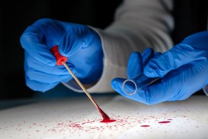 AUTISME : Un nouveau type de test sanguin à l'étude