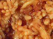 #thelancetgastroenterologyandhepatology #chromoendoscopie #autofluorescence #Chromoendoscopie #coliteulcéreuse versus imagerie autofluorescence pour détection néoplasies chez patients atteints colite ulcéreuse ancienne (FIND-UC) essa...