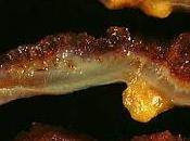 #thelancetgastroenterologyandhepatology #infliximab #biosimilaire Concentrations sériques après passage traitement infliximab princeps biosimilaire CT-P13 chez patients atteints maladie inflammatoire intestinale inactive (SECURE) étude o...