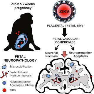 #Cell #singerhésus #Zika Neuropathologie fœtale chez des singes rhésus femelles gravides infectées par le virus Zika