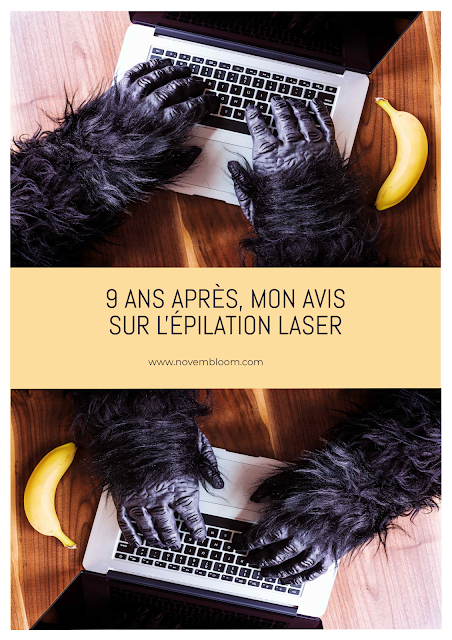 9 ans après, mon avis sur l'épilation laser