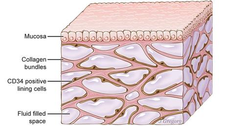 L'interstitium, ici sous une muqueuse (mucosa), comprend des compartiments interconnectés, emplis de liquide, soutenus par un réseau de protéines (collagen). Des cellules tapissent les espaces. © Jill Gregory,