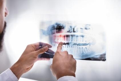 Ce matériau se montre capable de régénérer l'émail dentaire et plus largement les tissus durs dont les os.